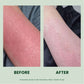Before & After Skin Results - Skin Visibly Improved, Nurture Body Lotion