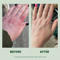 Before and After Nurture Lotion for Vulnerbale Skin